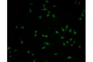 Immunofluorescence staining of SH-SY5Y cells with ABIN7152433 at 1:100, counter-stained with DAPI. (FBXO36 anticorps  (AA 1-188))