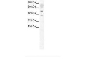Image no. 2 for anti-Acetyl-CoA Acetyltransferase 2 (ACAT2) (AA 174-223) antibody (ABIN202424) (ACAT2 anticorps  (AA 174-223))