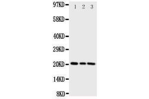Western Blotting (WB) image for anti-Phosphatidylethanolamine Binding Protein 1 (PEBP1) (AA 15-29), (N-Term) antibody (ABIN3044276) (PEBP1 anticorps  (N-Term))