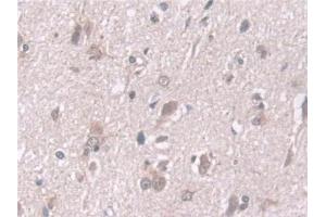 Detection of EXOSC2 in Human Cerebrum Tissue using Polyclonal Antibody to Exosome Component 2 (EXOSC2)