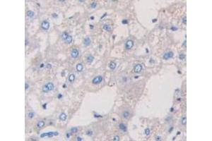 IHC-P analysis of Human Tissue, with DAB staining. (TRPA1 anticorps  (AA 63-370))