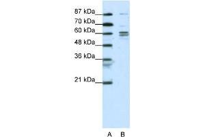 WB Suggested Anti-GTF2F1  Antibody Titration: 0.