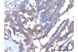 IHC analysis of RAP1GAP using anti-RAP1GAP antibody (ABIN7599729). (RAP1GAP anticorps  (AA 11-661))