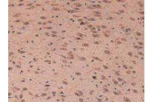 IHC-P analysis of Mouse Brain Tissue, with DAB staining. (IGFBP7 anticorps  (AA 88-281))