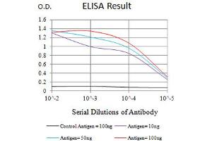 Black line: Control Antigen (100 ng),Purple line: Antigen (10 ng), Blue line: Antigen (50 ng), Red line:Antigen (100 ng)