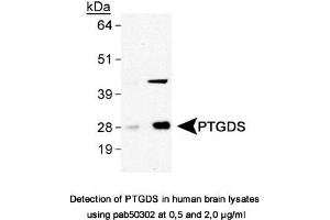 Image no. 1 for anti-Prostaglandin D2 Synthase (PTGDS) antibody (ABIN363611) (PTGDS anticorps)