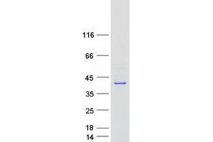 Validation with Western Blot