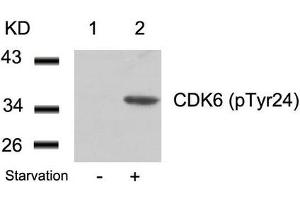 Western blot analysis of extracts from 293 cells untreated(lane 1) or treated with starvation(lane 2) using CDK6(phospho-Tyr24) Antibody. (CDK6 anticorps  (pTyr24))