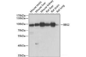 Western blot analysis of extracts of various cell lines using BBS2 Polyclonal Antibody at dilution of 1:1000. (BBS2 anticorps)