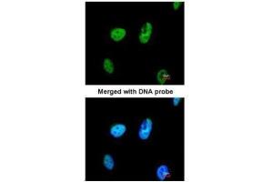 ICC/IF Image Immunofluorescence analysis of paraformaldehyde-fixed HeLa, using TATDN1, antibody at 1:200 dilution.