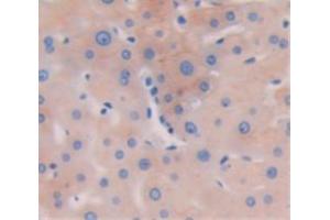 Used in DAB staining on fromalin fixed paraffin- embedded liver tissue
