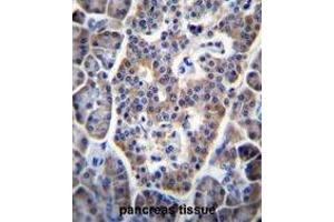 TP53INP1 Antibody (C-term) immunohistochemistry analysis in formalin fixed and paraffin embedded human pancreas tissue followed by peroxidase conjugation of the secondary antibody and DAB staining. (TP53INP1 anticorps  (C-Term))