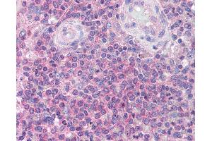 Anti-IRAK4 antibody IHC of human spleen.