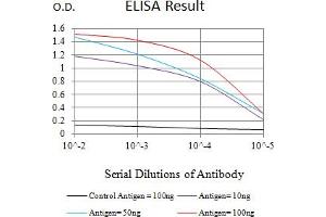 Black line: Control Antigen (100 ng),Purple line: Antigen (10 ng), Blue line: Antigen (50 ng), Red line:Antigen (100 ng)