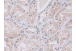 Detection of GLa in Human Kidney Tissue using Polyclonal Antibody to Galactosidase Alpha (GLa) (GLA anticorps  (AA 81-429))