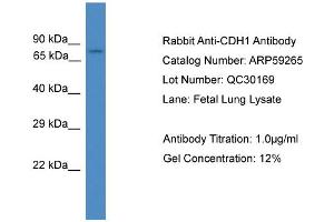 WB Suggested Anti-CDH1  Antibody Titration: 0.