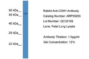 WB Suggested Anti-CDH1  Antibody Titration: 0. (E-cadherin anticorps  (Middle Region))