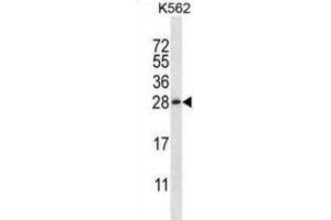 Western Blotting (WB) image for anti-Chorionic Somatomammotropin Hormone-Like 1 (CSHL1) antibody (ABIN2997108) (CSHL1 anticorps)