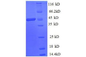 Spermidine/spermine N1-Acetyltransferase 1 (SAT1) (AA 5-171) protein (GST tag)