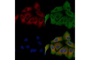 ABIN6257094 and ABIN6275278 staining Hela cells by IF/ICC. (CYB5R3 anticorps  (C-Term))