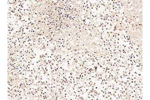 Immunohistochemistry of Goat Anti-GRK2 Antibody Immunohistochemistry of Goat Anti-GRK2 Antibody.