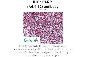 Image no. 3 for anti-Poly (ADP-Ribose) Polymerase 1 (PARP1) antibody (ABIN1723251)