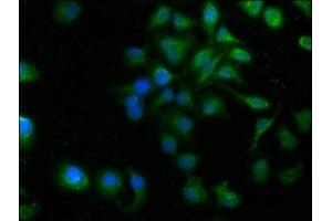 Immunofluorescence staining of A549 cells with ABIN7166440 at 1:100, counter-stained with DAPI. (PORCN anticorps  (AA 269-332))