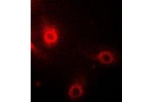 Immunofluorescent analysis of Aminoacylase 1 staining in Hela cells. (Aminoacylase 1 anticorps)