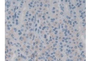 Detection of TRPM7 in Rat Stomach Tissue using Polyclonal Antibody to Transient Receptor Potential Cation Channel Subfamily M, Member 7 (TRPM7)