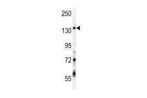 GPRASP1 Antibody (C-term) (ABIN652013 and ABIN2840496) western blot analysis in Jurkat cell line lysates (35 μg/lane). (GPRASP1 anticorps  (C-Term))
