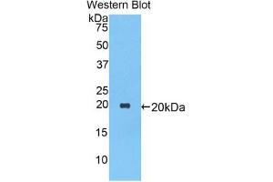 Detection of Recombinant a1AT, Rat using Polyclonal Antibody to Alpha-1-Antitrypsin (a1AT)