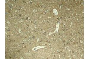 Immunohistochemical staining of rat hippocampal region tissue from a model with Alzheimer using MAPT (phospho S404) polyclonal antibody  under 1:50-1:100 dilution.