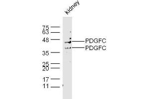 Mouse kidney lysates probed with Rabbit Anti-PDGFC Polyclonal Antibody, Unconjugated  at 1:500 for 90 min at 37˚C. (PDGFC anticorps  (AA 201-300))