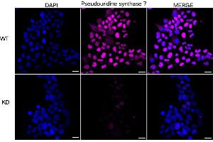 anti-Pseudouridylate Synthase 7 Homolog (PUS7) antibody