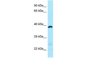 WB Suggested Anti-ABHD6 Antibody Titration: 1. (ABHD6 anticorps  (C-Term))