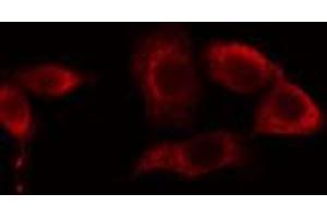 ABIN6274656 staining LOVO cells by IF/ICC. (CYP39A1 anticorps  (C-Term))