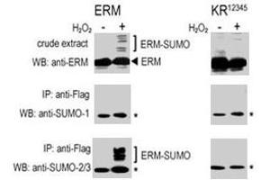 COS-7 cells were transfected for 24 hrs with a plasmid expressing FLAG-ERM (left panels) or FLAG-ERM KR12345 (right panels) . (SUMO1 anticorps  (C-Term))
