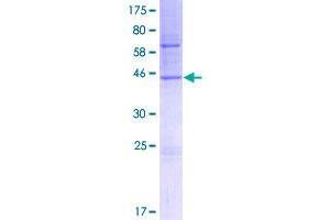 Image no. 1 for Transmembrane and Coiled-Coil Domains 1 (TMCO1) (AA 1-188) protein (GST tag) (ABIN1322917)