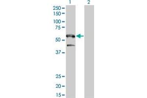 Western Blot analysis of SH2B1 expression in transfected 293T cell line by SH2B1 monoclonal antibody (M01), clone 2B9. (SH2B1 anticorps  (AA 327-426))