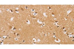 Immunohistochemistry of paraffin-embedded Human brain tissue using ARHGEF1 Polyclonal Antibody at dilution 1:50 (ARHGEF1 anticorps)