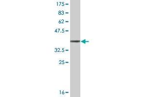 Western Blot detection against Immunogen (36. (TNNT3 anticorps  (AA 161-258))