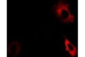 Immunofluorescent analysis of AKR7A2 staining in Hela cells.