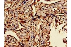 Immunohistochemistry of paraffin-embedded human placenta tissue using ABIN7172536 at dilution of 1:100 (TFEB anticorps  (AA 1-476))