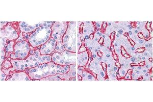 anti collagen IV antibody (600-401-106 Lot 25440, 1:400, 45 min RT) showed strong staining in FFPE sections of human kidney (Left) with strong red staining observed in glomeruli and liver (Right) with strong staining in sinusoids. (Collagen IV anticorps)