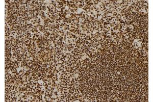 ABIN6278728 at 1/100 staining Mouse spleen tissue by IHC-P. (ERCC6 anticorps  (Internal Region))