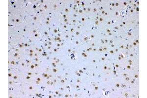 IHC analysis of MED15 using anti-MED15 antibody .