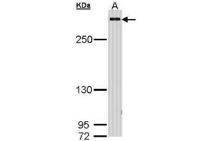Western Blotting (WB) image for anti-CREB Binding Protein (CREBBP) (C-Term) antibody (ABIN2854987)