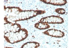 IHC analysis of formalin-fixed, paraffin-embedded human colon.