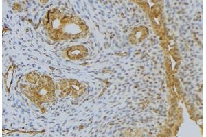 ABIN6276488 at 1/100 staining Human uterus tissue by IHC-P. (DEFB132 anticorps)