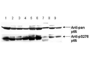Image no. 4 for anti-Nuclear Factor-kB p65 (NFkBP65) (pSer276) antibody (ABIN1103942) (NF-kB p65 anticorps  (pSer276))
